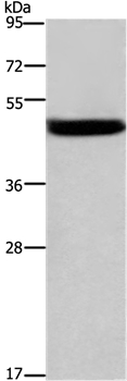 Anti-CTSE Antibody