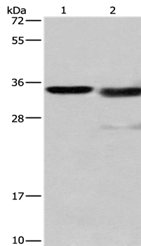 Anti-CTSL Antibody
