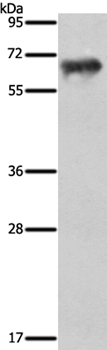 Anti-FSHR Antibody