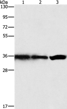 Anti-GNB1 Antibody