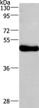 Anti-UGCG Antibody