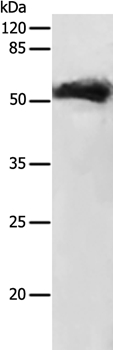 Anti-GDF9 Antibody