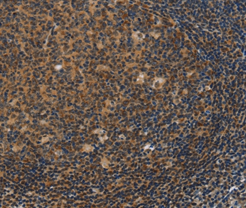 Anti-IRF9 Antibody Anti-IRF9 Antibody