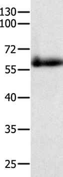 Anti-PAK4 Antibody
