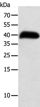 Anti-SYT5 Antibody