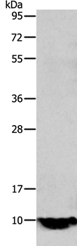 Anti-TFF1 Antibody