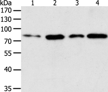 Anti-TGM2 Antibody
