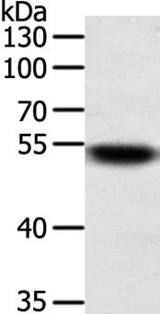 Anti-SUFU Antibody