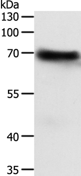 Anti-FZD4 Antibody
