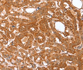 Anti-CNN3 Antibody Anti-CNN3 Antibody