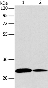 Anti-ATG5 Antibody