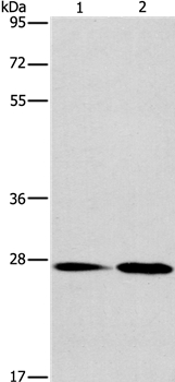 Anti-NAT8 Antibody