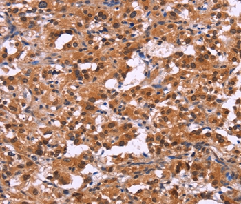 Anti-XPO1 Antibody Anti-XPO1 Antibody