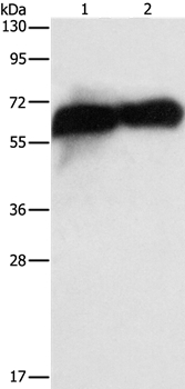 Anti-ALPP Antibody