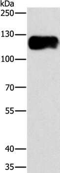 Anti-CAST Antibody