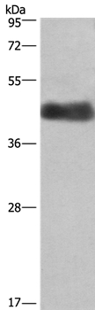 Anti-CALU Antibody