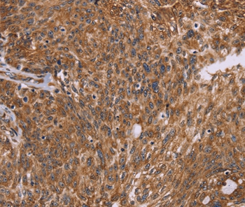 Anti-PPIB Antibody Anti-PPIB Antibody