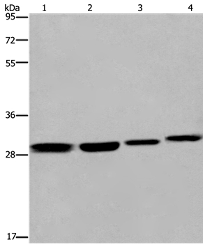 Anti-ETV7 Antibody