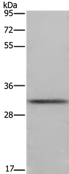 Anti-FCAR Antibody