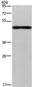 Anti-FGL2 Antibody