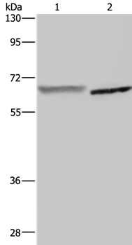 Anti-GCKR Antibody