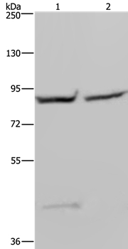 Anti-GYS1 Antibody