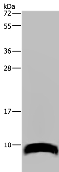 Anti-GNG2 Antibody
