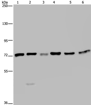 Anti-KARS Antibody