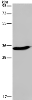 Anti-KLK6 Antibody