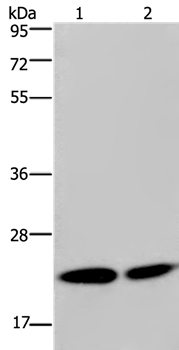 Anti-NPM3 Antibody