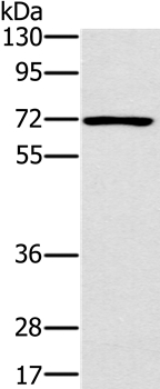 Anti-PLS3 Antibody
