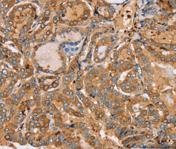 Anti-PLS3 Antibody Anti-PLS3 Antibody