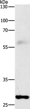 Anti-FGF2 Antibody