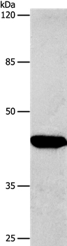 Anti-CTGF Antibody