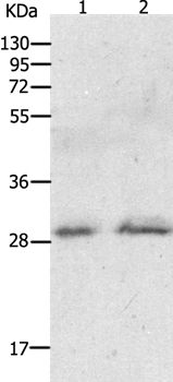 Anti-GCH1 Antibody