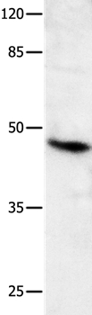 Anti-MLNR Antibody