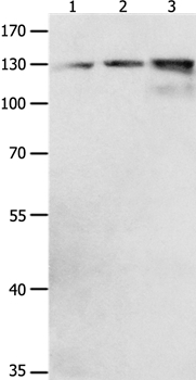 Anti-CDH1 Antibody