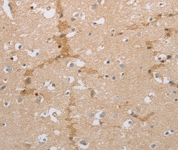 Anti-NCAN Antibody Anti-NCAN Antibody