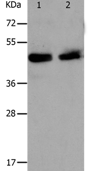 Anti-PAWR Antibody