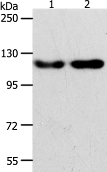 Anti-ABL2 Antibody
