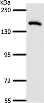 Anti-AFF2 Antibody