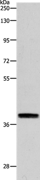 Anti-RTN4 Antibody
