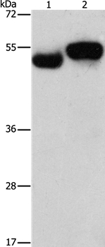 Anti-AMZ1 Antibody