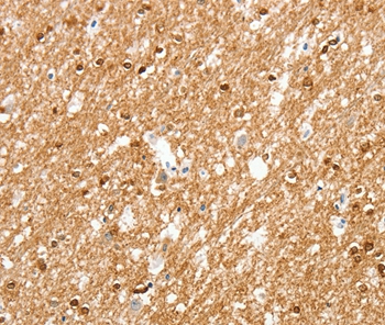 Anti-AMZ1 Antibody Anti-AMZ1 Antibody