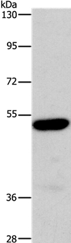 Anti-ARSB Antibody