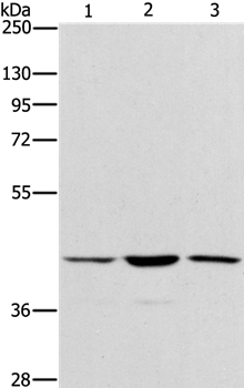 Anti-IBSP Antibody