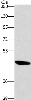 Anti-BRS3 Antibody
