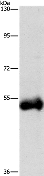 Anti-CTSC Antibody