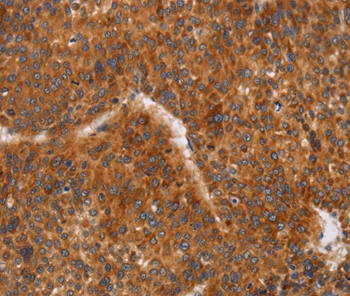 Anti-CD38 Antibody Anti-CD38 Antibody