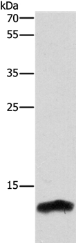 Anti-CSTB Antibody